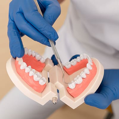 Passer d’une prothèse amovible à des dents fixes en 1 jour, comment ça marche ?
