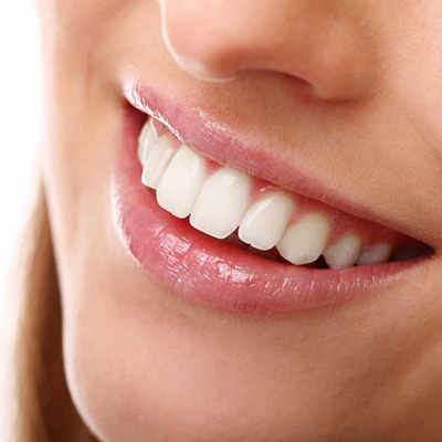 Comment garder mes dents blanches ?